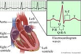 Lipid Profile and ECG Relationship: Course of Heart Failure Risk