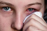 Symptoms of Conjunctivitis