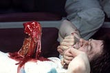 Emergency organ removal in Russia
