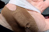 Close-up of a bandaged hand