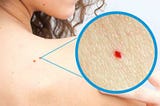Do you have red dots on skin? Then you should be worried!