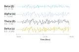 The Introductory Guide to EEG (Electroencephalography)