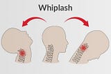 Coping with Mental Health After a Whiplash Injury