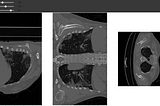 Interactive 3d CT slices visualisation in Google Colab