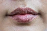 8 simple tips to get rid of chapped/dry lips.