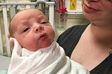 Its heart breaking, Calgary couple who gave birth to Butterfly baby.