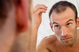 Receding Hairline: A Guide to some ingenious Solutions to Regain Your Hair