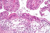 How to get top 1% on Kaggle and help with Histopathologic Cancer Detection
