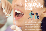 Dental Implant Services in Dubai ‼