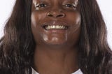 Ohio State women’s basketball forward Ashanti Abshaw out with yet another ACL injury.