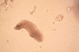 Brain-eating Amoeba Strikes Again: Texas Woman Dies After Using Nasal Irrigation Device