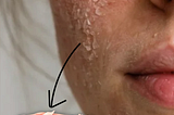 Your Glass Skin Routine Might Be Damaging Your Barrier