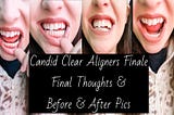 CANDID CLEAR ALIGNERS FINALE // Final Thoughts & Before and After Pics