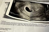 a close up of an ultrasound entitled “fetus A” lays on a white sheet of paper. The text explains the finding of an ultrasound, twins.