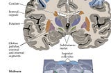 Neuropathology of Huntington’s Disease