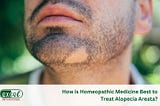 How Homeopathic Medicine Best to Cure Alopecia Areata?