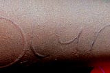 DERMATOGRAPHIA