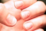 How To Strengthen Weak and Brittle Nails