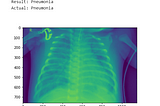 Diagnosing Pneumonia with Deep Learning