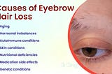 Get Effective Eyebrow Hair Loss Treatment with Personalized Homeopathic Medicines