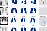 The best approach to semantic segmentation of biomedical images