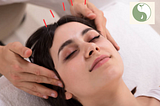 Benefits of Facial Acupuncture