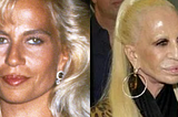 Donatella Versace: Natural Aging vs. Potential Cosmetic Enhancements