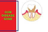 Gum Disease Gone: A Deep Dive into a Natural Solution for a Widespread Problem