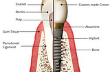 3D Printing and the Advent of Digital Dentistry