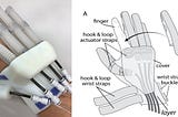 Soft Robotic Hand for Stroke Rehabilitation