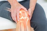 Arthritis — Specialty Care Clinics