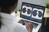 Revolutionizing Cancer Detection and Diagnosis with Artificial Intelligence in Healthcare