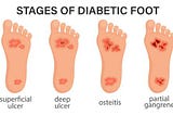 diabetic foot ulcer stages