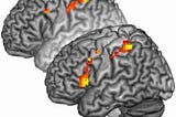 Is empathy characterised by neurons rather than free choice? Mirror neurons are still in discussion