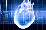 Machine Leaning Predicts Early Type 2 Diabetes Using Electrocardiogram Data