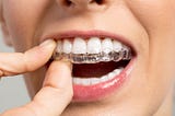 Do Invisible Braces Work for Everyone To Straighten Teeth?