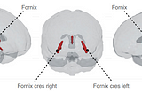 Loneliness Changes the Brain