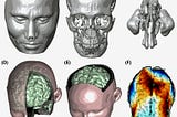 What Deep Learning Models to Use with 3D MRI and CT Scans?