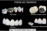 Types Of Crowns