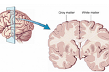 Rare Genetic Diseases: RPI Deficiency