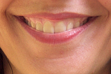Le sourire