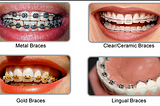 Capture Life Dental Care is one of the best orthodontic dental clinic Banjara Hills has in…