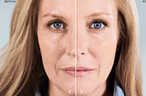 How Much Does 10 Vials of Sculptra Cost? Unveiling the Price of Facial Rejuvenation