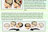 Traumatic brain injuries can be caused by a variety of different mechanisms.