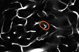 Identifying Alzheimers Related Blood Stalls In The Brains of Mice Using Deep Learning