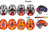 Study Shows How LSD Mimics Infant’s Mind as Ego Dissolves, by Paul Ratner