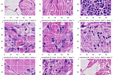 Histopathologic cancer detection as image classification using Pytorch