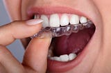 Benefits of Invisalign