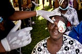 June: Cataract Awareness Month — Let’s Shed Light on Needless Blindness