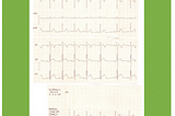 ECG & ascoltazione cardiaca
(ID: MGL150227): la tua diagnosi?